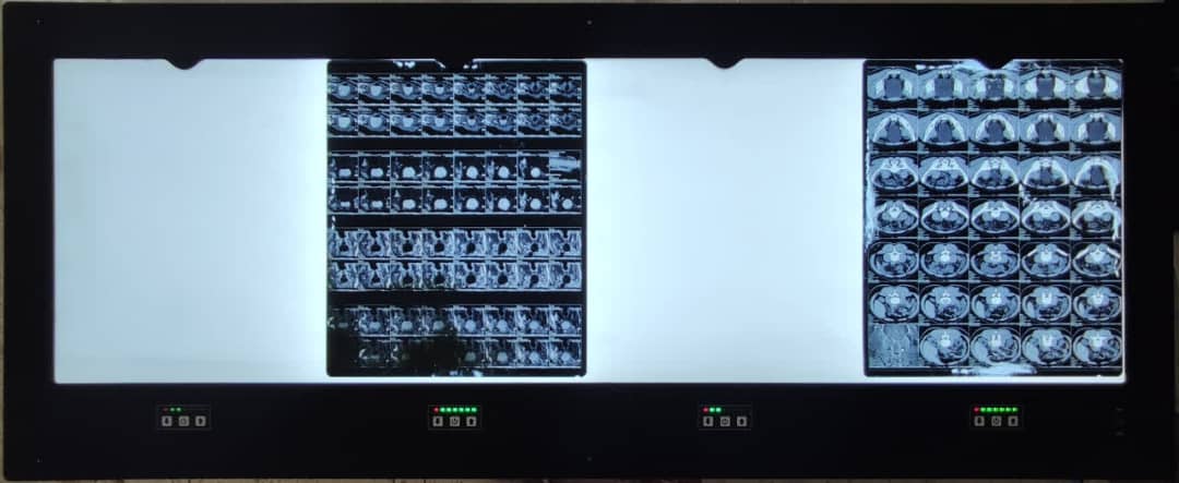 IMG-20240609-WA0030-2.jpg نگاتسكوپ چهار خانه LED - تصویر 1